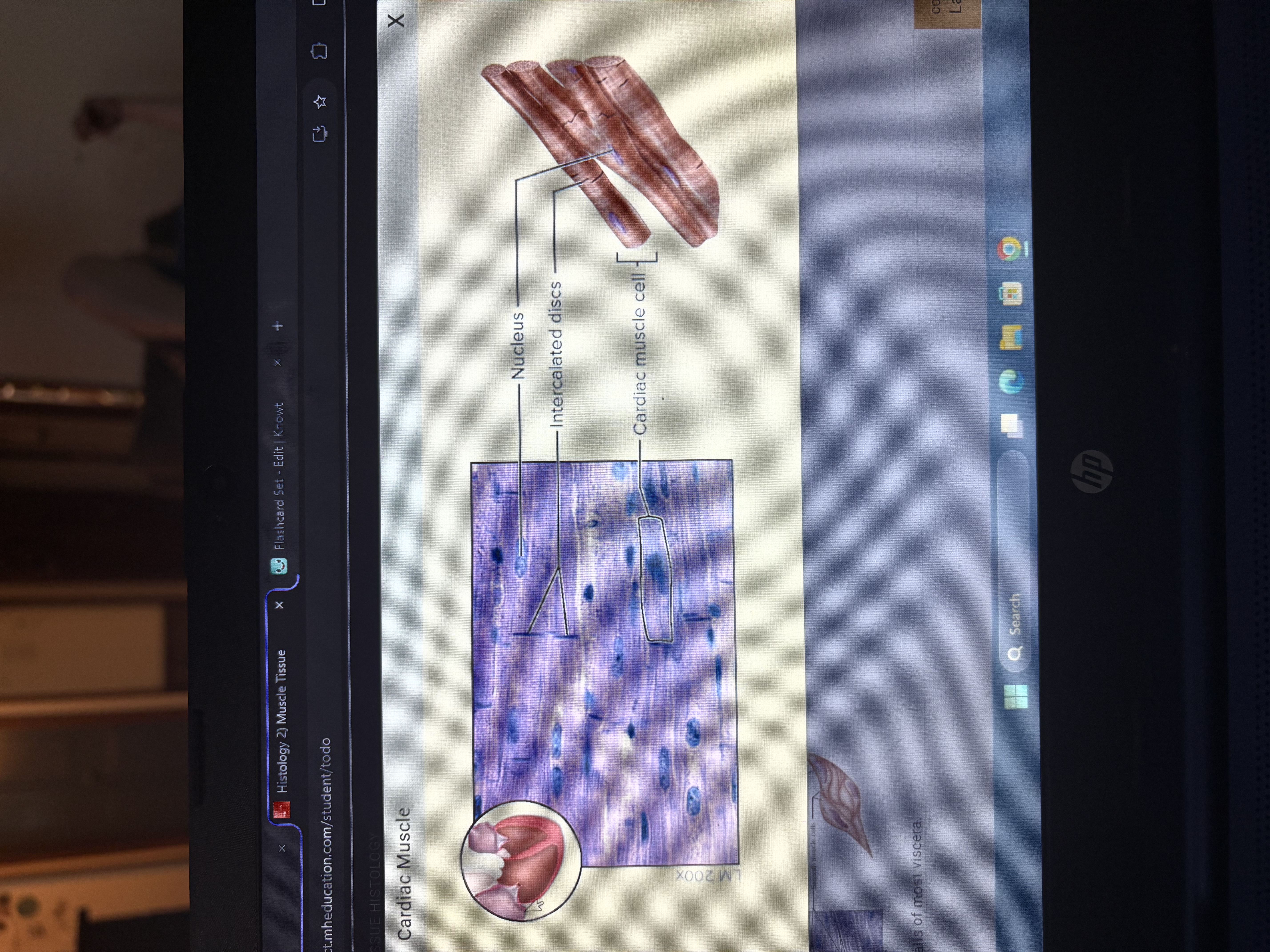 <p>Found in the wall of the heart</p><p>Cells are short, branched, striated, and uni or binucleate.</p>