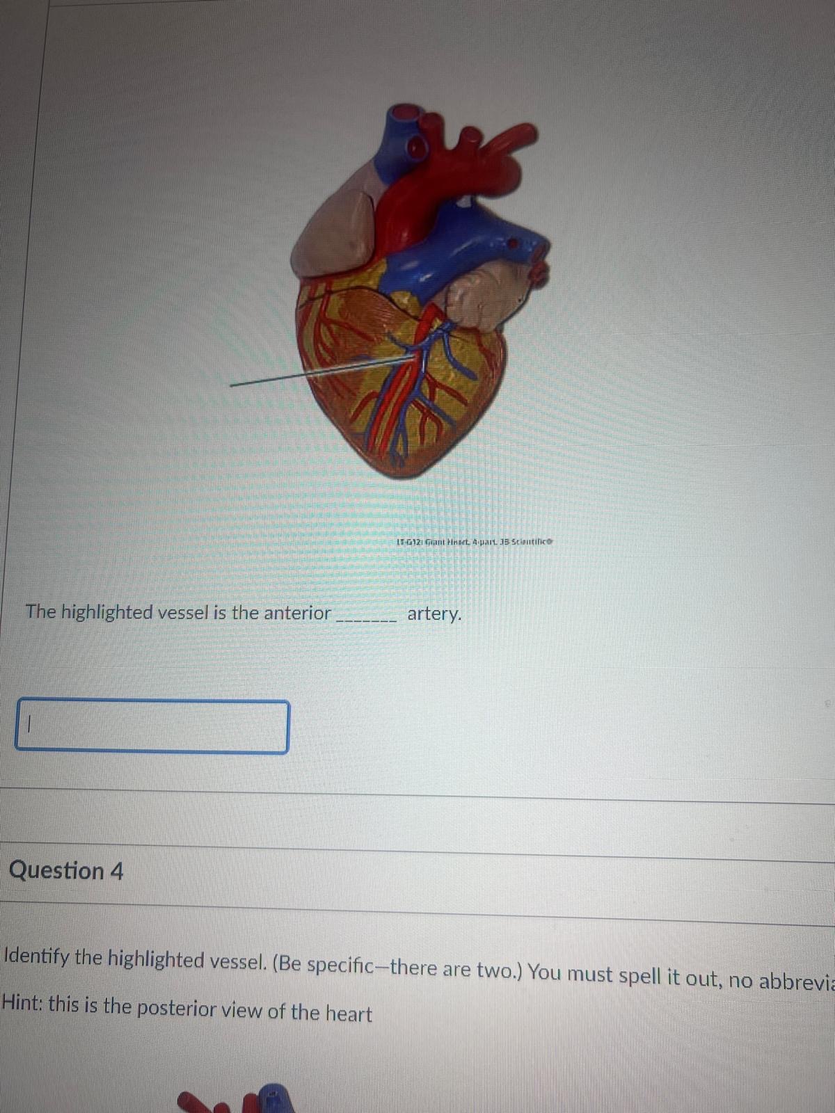 <p><span>The highlighted vessel is the anterior BLANK artery.</span></p>