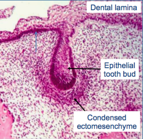 <p><strong><span style="font-family: Times New Roman, serif">This is the first stage where tooth development occurs. The epithelium (outer layer) burrows into the mesenchyme (inner layer). The mesenchyme cells condense around the bottom of the ‘bud’. Epithelial cells remain functioning as epithelial cells; do not change in shape or function.</span></strong></p>