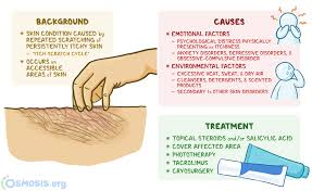 <p>PP: chronic rubbing+scratching→beyond normal pain threshold→thick+leathery skin+exaggerated skin markings</p><p>E: neck (back+sides)<br>wrists<br>ankles<br>gradual insidious onset<br>skin site of another condition</p><p>CM: thick+leathery skin<br>exaggerated skin markings→lichenification</p><p>TX:<br>high potency topical steroid + temporary<br>steroid tape<br>intra-lesional kenalog</p>