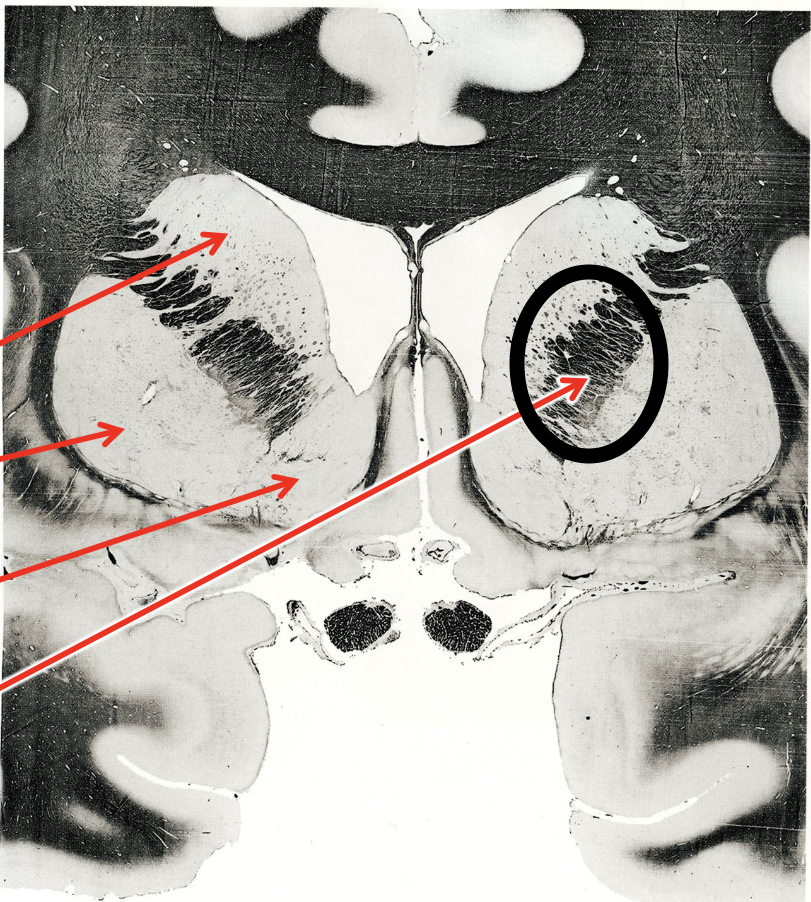 <p>what is the circled region?</p>