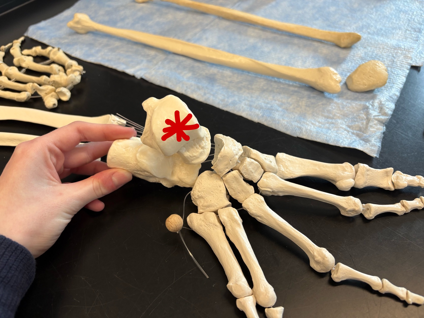 <p>Name this bone</p>