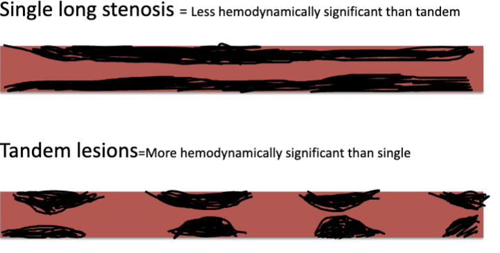 <p>What is a tandem stenosis </p>