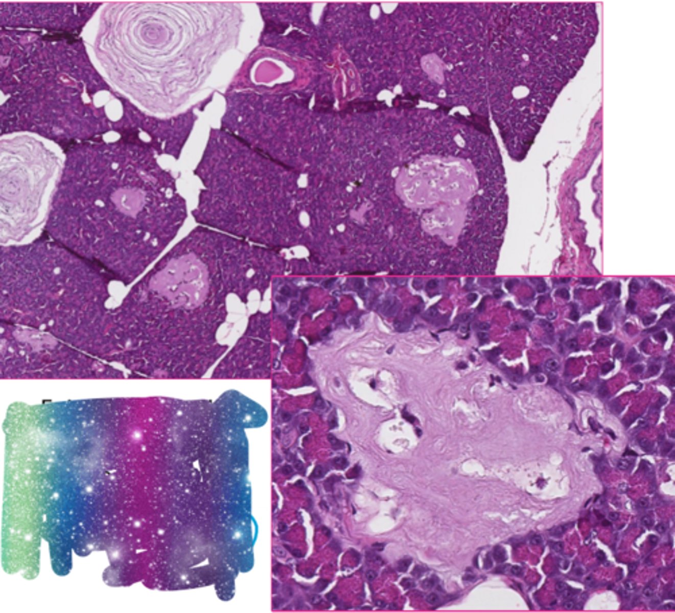 <p>describe the extracellular inclusion</p>
