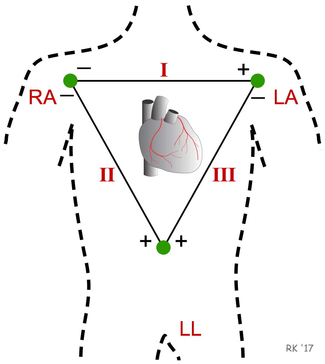 <p>used primarily for basic heart monitoring</p>