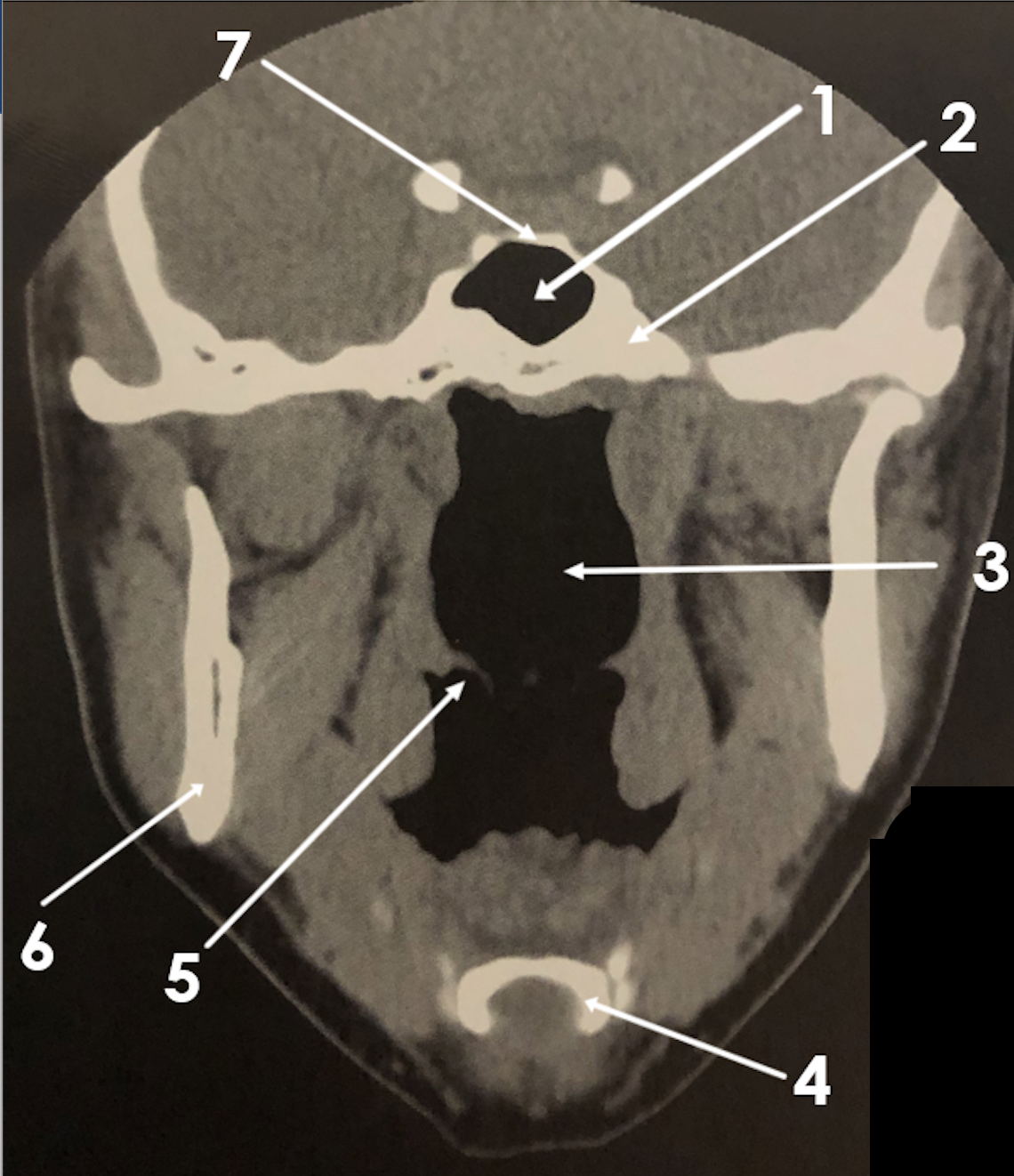 <p>2</p>