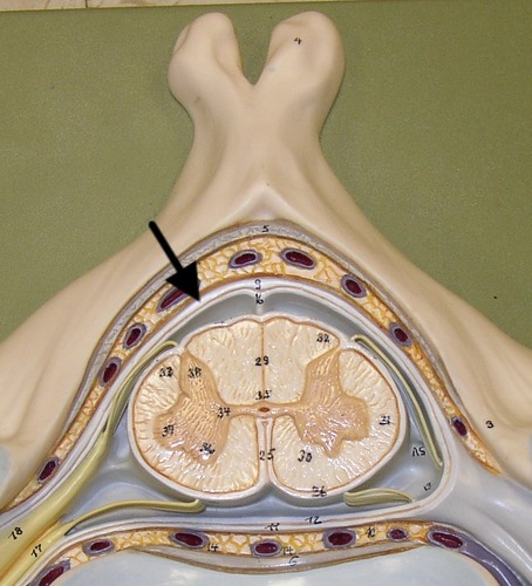 <p>a thick fibrous layer and a strong protective sheath over the entire brain and spinal cord. It is anchored to the inner surface of the cranium and vertebral cavity</p>