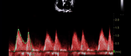 <p>what is this measurement for </p>