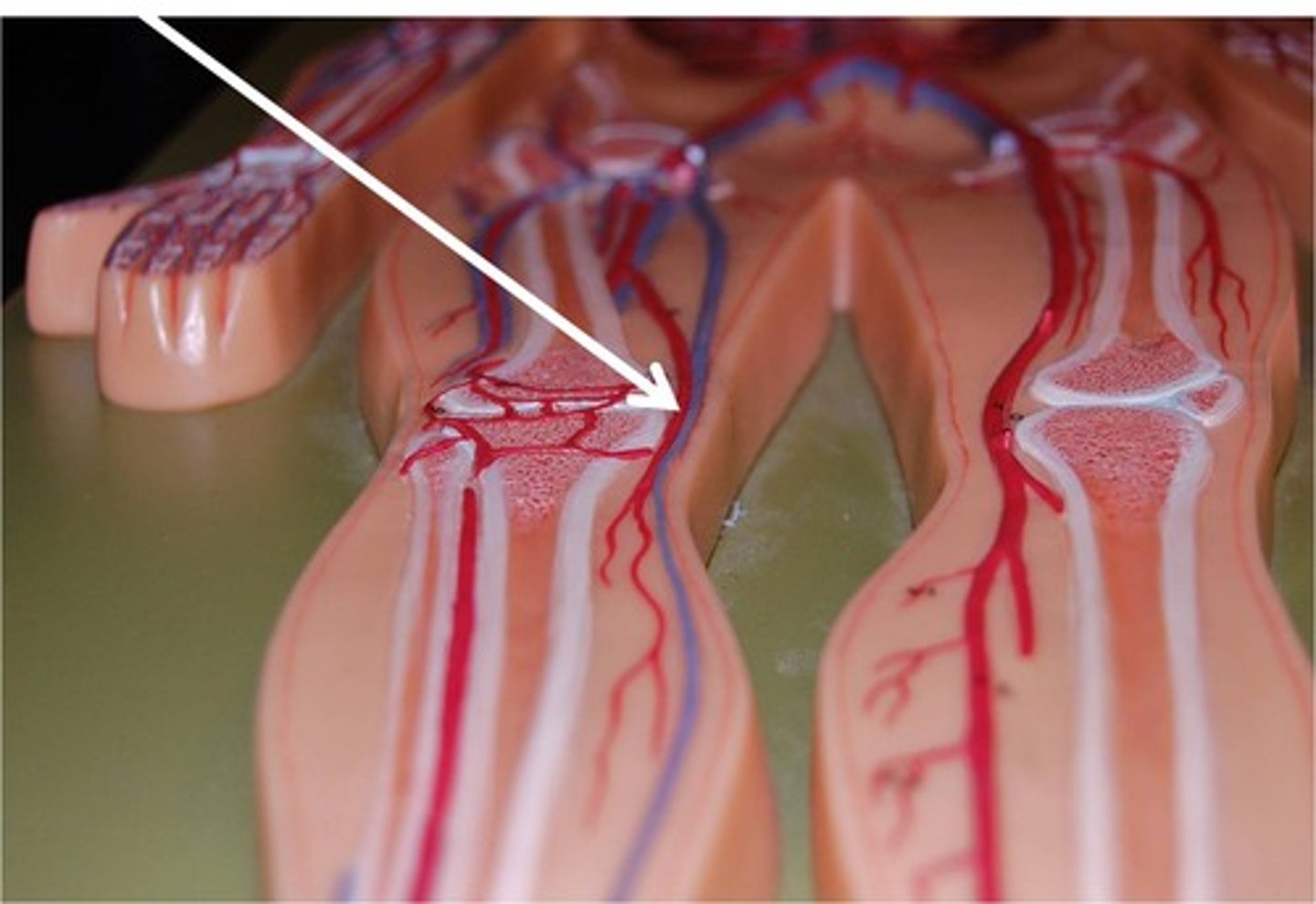 <p>form from the merger of the anterior and posterior tibial veins just inferior to the popliteal fossa; become the femoral veins just superior to the knee</p>