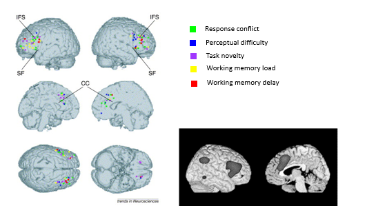 <ul><li><p>Not everyone believes that it is possible to fractionate the PFC into separate executive processes.</p></li><li><p>Duncan &amp; Owen (2000) performed a meta-analysis of neuroimaging studies of executive function → plotted the activations associated w/multiple different processes, e.g. response conflict, task novelty, on a single brain</p></li><li><p>found was that rather than there being separate regions of PFC dedicated to different processes, the different processes all activated remarkably similar regions</p></li><li><p>No clear separation between diff processes → there was a network of regions, encompassing regions in the lateral PFC, anterior insula, medial PFC, &amp; inferior parietal cortex, that all seemed to show increased activation when subjects did something cognitively difficult.</p></li><li><p>Duncan called the frontoparietal ‘multiple demand’ network</p><ul><li><p>reflecting that this is a ‘multi-purpose’ network of brain regions that underlies cognitive performance in multiple types of demanding tasks</p></li><li><p>when we need it → its for harder cognitive functions </p></li></ul></li><li><p>there is no clear pattern </p></li></ul><p></p>