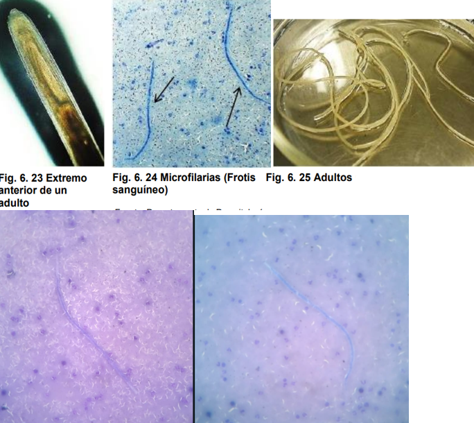 <ul><li><p>localización: ventrículo derecho, atrio derecho, arteria pulmonar y vena cava posterior. (Microfilarias en torrente sanguíneo L1)</p></li><li><p>Huésped intermediario: moscos hematófagos culex, aedes y anopheles</p></li><li><p>Huésped final: perro y gato</p></li><li><p>Ciclo de vida indirecto</p></li><li><p>Cavidad oral es pequeña, y la cutícula presenta estaciones.</p></li><li><p>M: extremo posterior termina en espiral, cola cónica y posee alas caudales, espiculas y NO tiene gubernaculo</p></li><li><p>H: extremo posterior es redondeado</p></li></ul><p>//Frotis sanguíneo L1// </p>