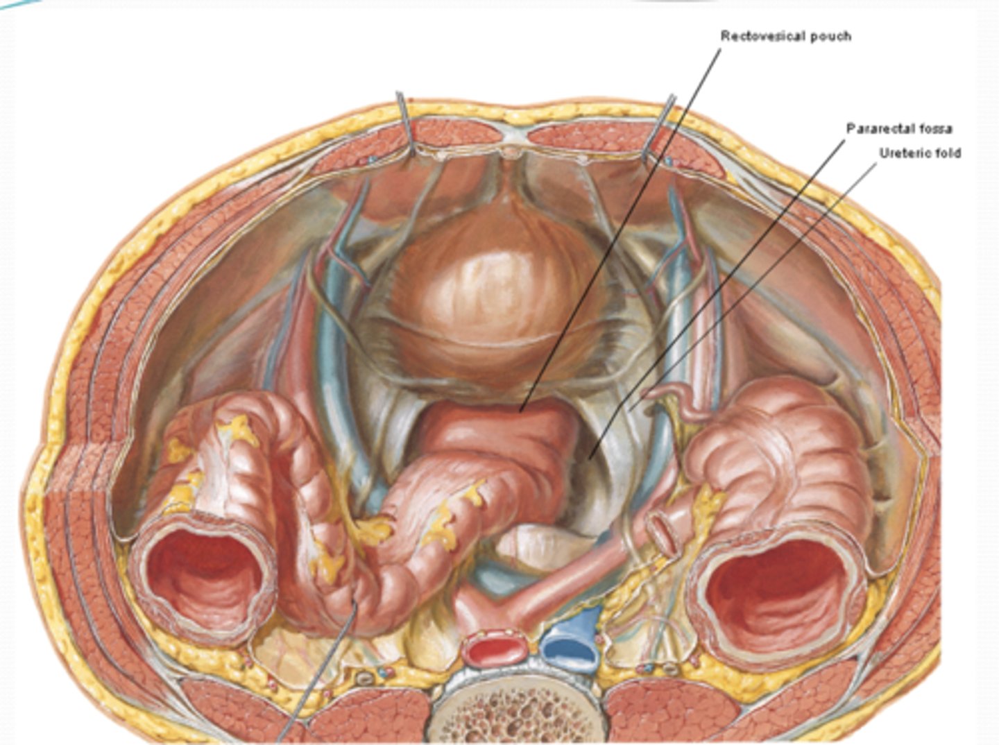 <p>What are the MALE peritoneal reflections? (3)</p>