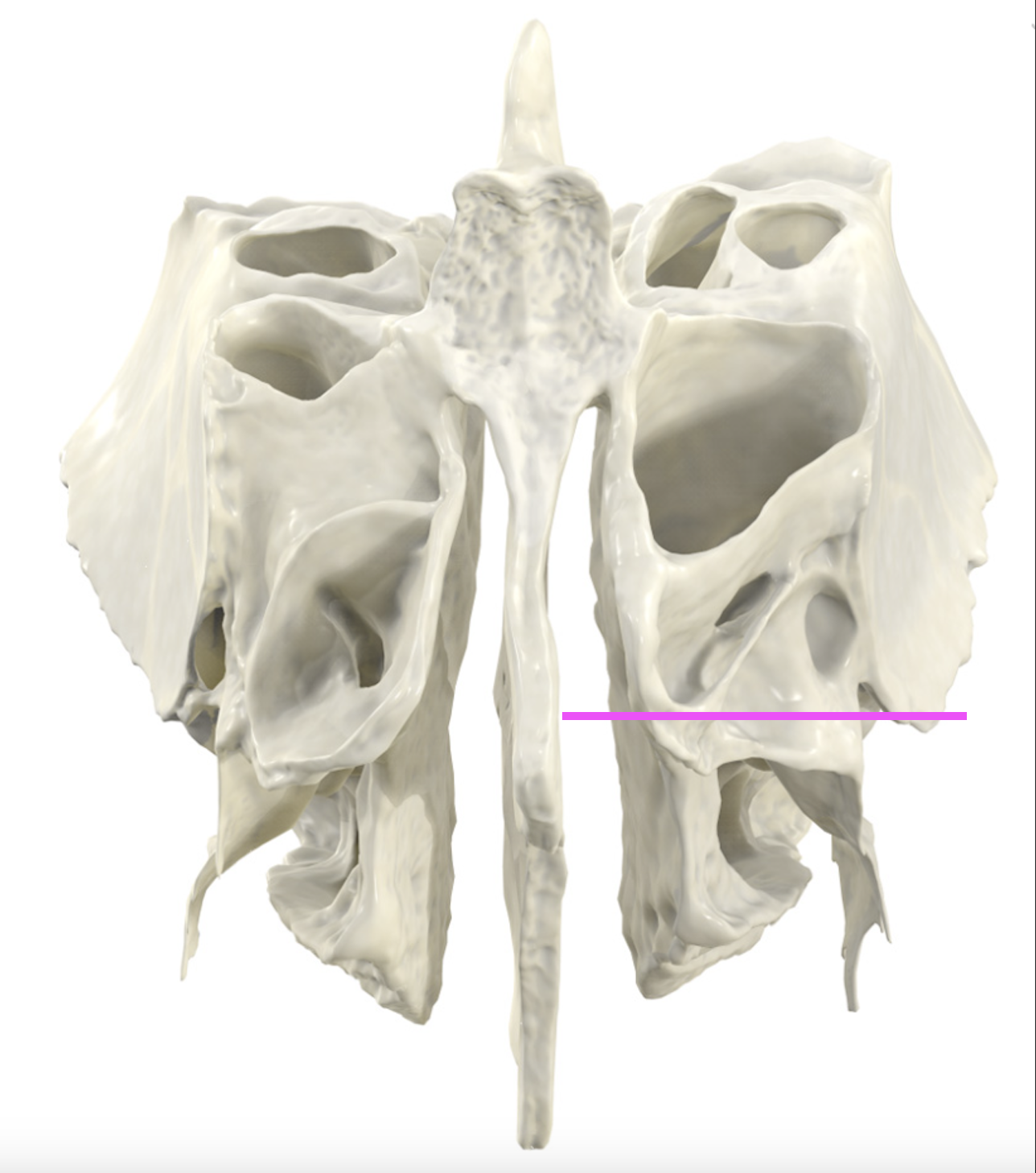 <p>What bone marking is this?</p>