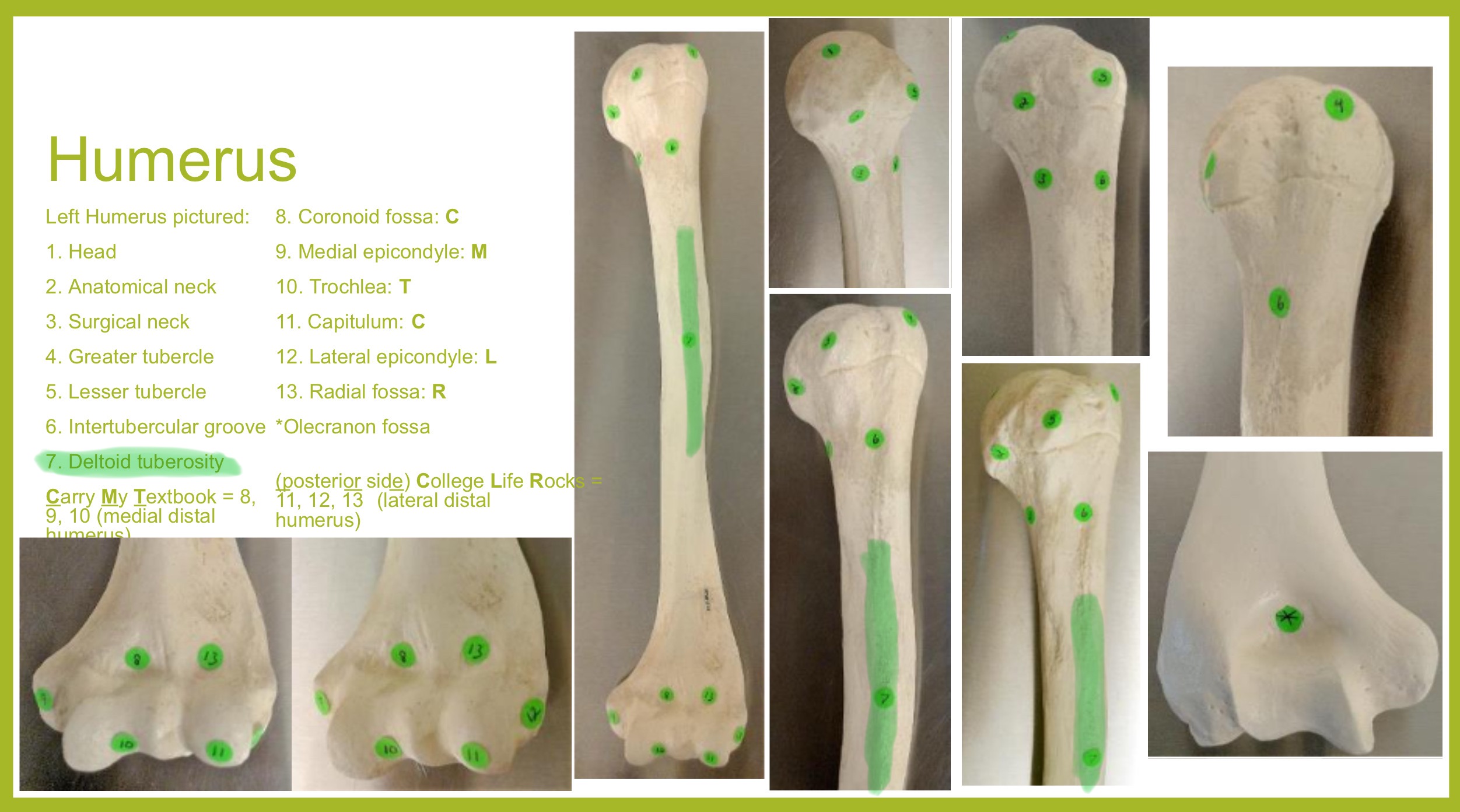 <p>deltoid tuberosity of humerus</p>