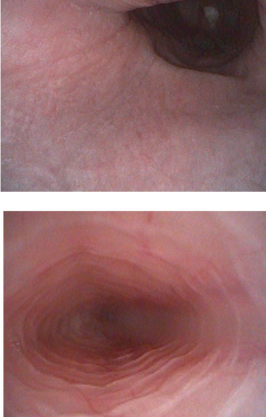 <p>dog: esophagus is entirely striated muscle</p><p>cat: proximal esophagus striated, distal is smooth muscle</p>