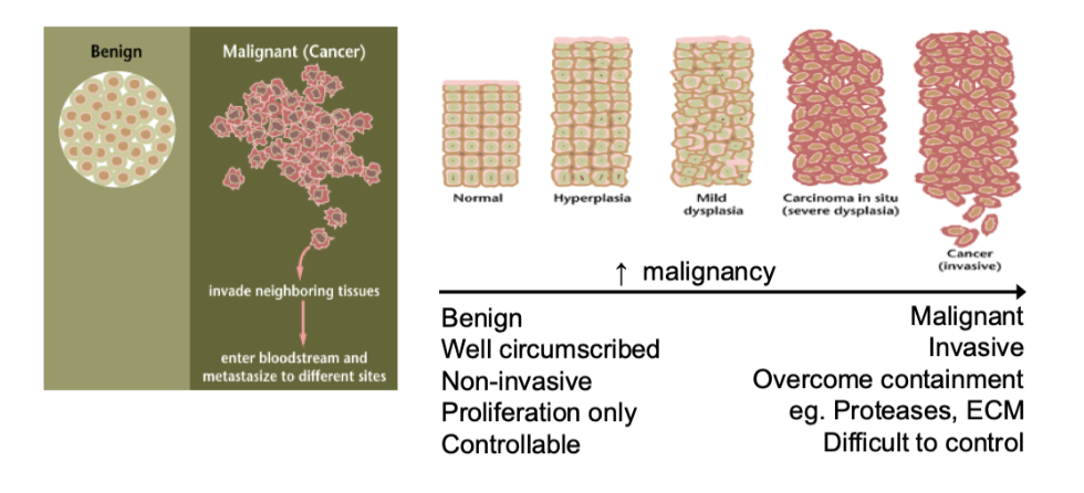 <p><span style="background-color: inherit; line-height: 22px; color: windowtext;"><span>Spectrum of tissue states and how cancerous they are&nbsp;</span></span><span style="line-height: 22px; color: windowtext;"><span>&nbsp;</span></span></p><p class="Paragraph SCXO184749153 BCX0" style="text-align: left;"><span style="line-height: 22px; color: windowtext;"><span>&nbsp;</span></span></p><p class="Paragraph SCXO184749153 BCX0" style="text-align: left;"><span style="background-color: inherit; line-height: 22px; color: windowtext;"><span>Hyperplasia- more cells than normally would be&nbsp;</span></span><span style="line-height: 22px; color: windowtext;"><span>&nbsp;</span></span></p><p class="Paragraph SCXO184749153 BCX0" style="text-align: left;"><span style="background-color: inherit; line-height: 22px; color: windowtext;"><span>Mild dysplasia- more cells and start to lose their organisation, shape and size</span></span><span style="line-height: 22px; color: windowtext;"><span>&nbsp;</span></span></p><p class="Paragraph SCXO184749153 BCX0" style="text-align: left;"><span style="background-color: inherit; line-height: 22px; color: windowtext;"><span>Cancer- invasive, leave and go to other body sites&nbsp;</span></span><span style="line-height: 22px; color: windowtext;"><span>&nbsp;</span></span></p>