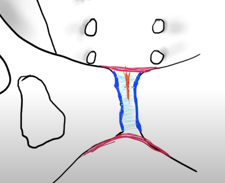 <p>Pubic symphysis</p>