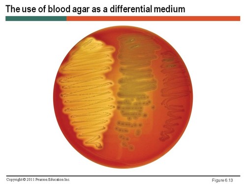 <ul><li><p><strong>Distinguishes one microorganism type from another growing on the same medium. Uses biochemical characteristics of a microorganism growing in the presence of specific nutrients/indicators added to the medium to <u>visibly</u> indicate the defining characteristics</strong></p></li><li><p>Examples: Blood agar plates (5% sheep blood)</p><ul><li><p>Beta-hemolytic - Organisms that produce <u>hemolysin</u> and can completely digest RBCs</p></li><li><p>Alpha-hemolytic- Produce enzymes that <u>partially</u> digest RBCs, greenish colored growth</p></li></ul></li></ul><p></p>