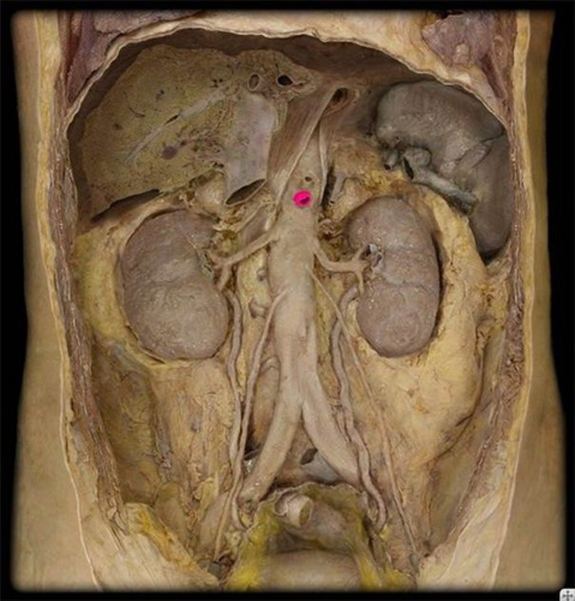 <p>Name this vessel.</p>