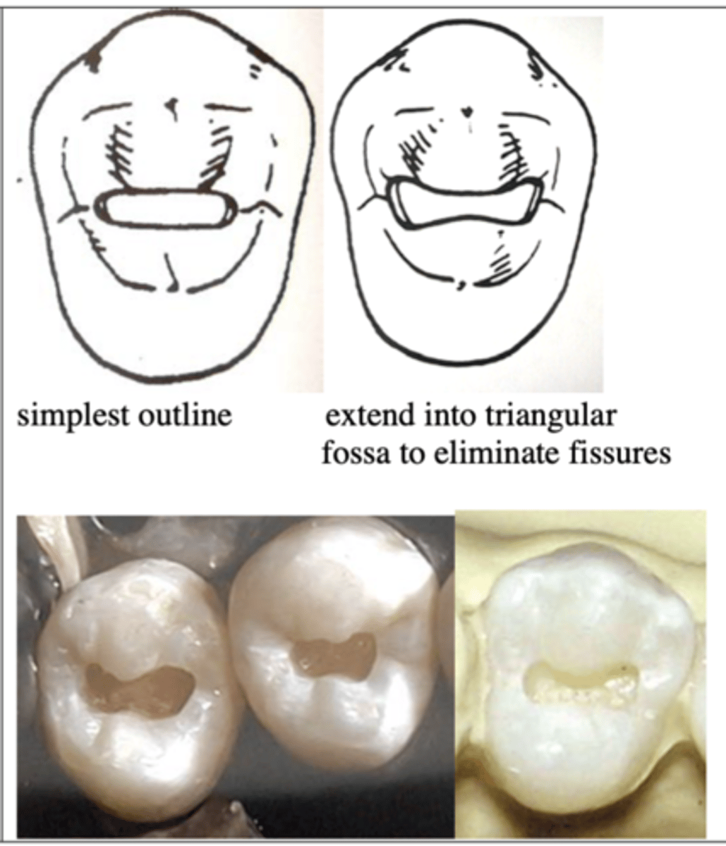 <p>primary fissure</p>