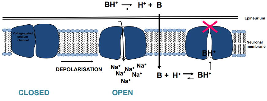 <p class=""></p><ul><li><p class="">Local anaesthetics are weak bases, injected as salts (ionised form).</p></li><li><p class="">They shift to the non-ionised form, allowing them to pass through the neuronal membrane.</p></li><li><p class="">Inside the cell, they return to the ionised form, blocking <strong>voltage-gated sodium channels</strong>.</p></li><li><p class="">This prevents depolarisation, stopping <strong>action potential</strong> and pain transmission.</p></li></ul><p></p>