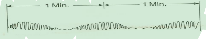<p>What type of breathing is this?</p>