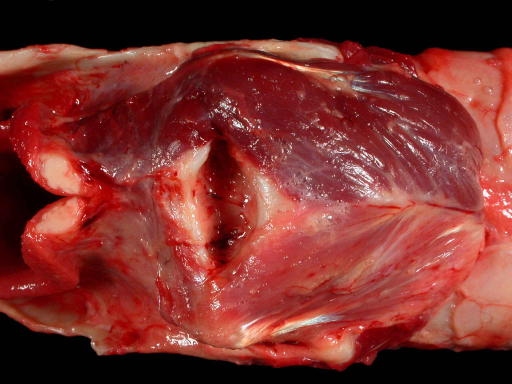 <p>What organ is this? Give a morphological description, morphological diagnosis, disease diagnosis, and possible cause</p>