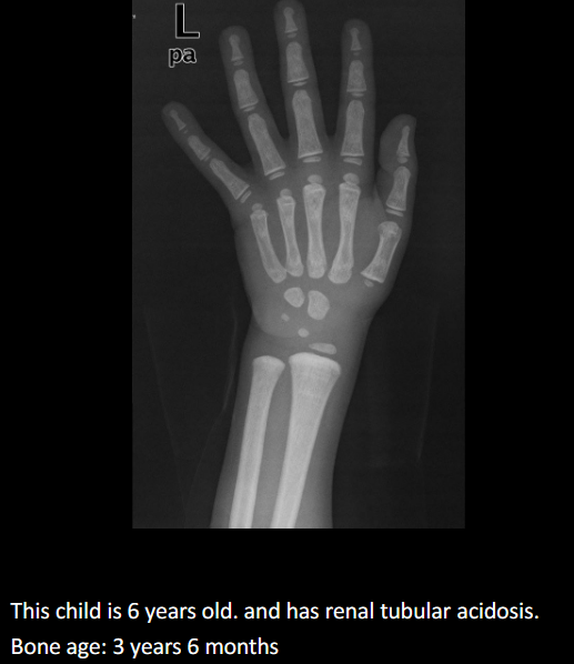 <p>Assess growth/endocrine issues, stature, puberty timing, predict adult height.</p>