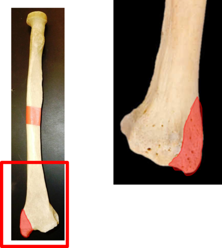 <p>insertion of brachioradialis</p>