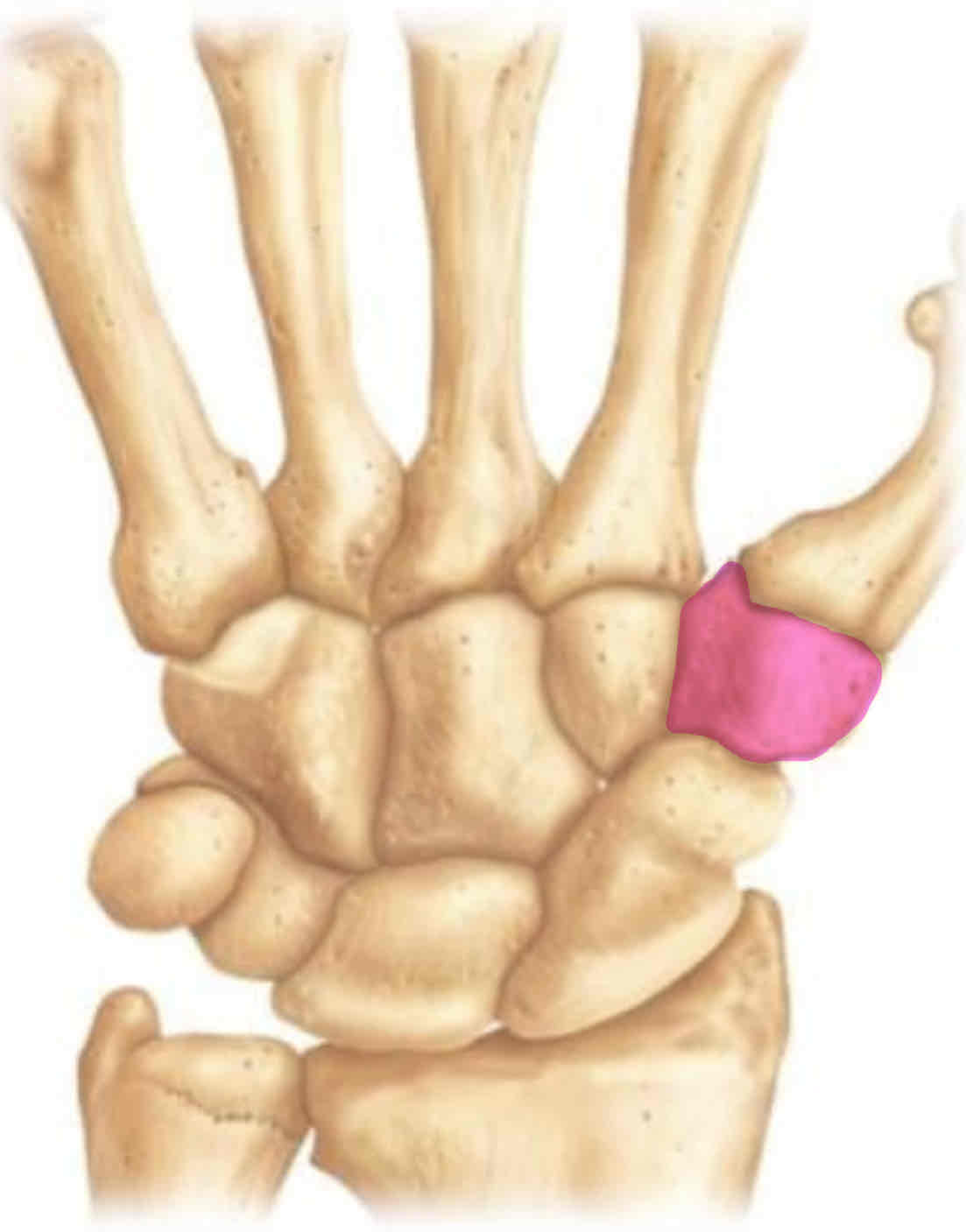 term image