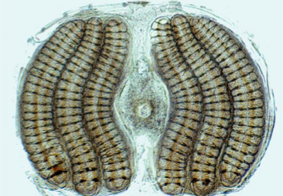 <p>What botfly genera does this spiracle belong to?</p>