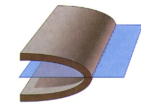 <p>extreme overturned, axial plane is horizontal</p>