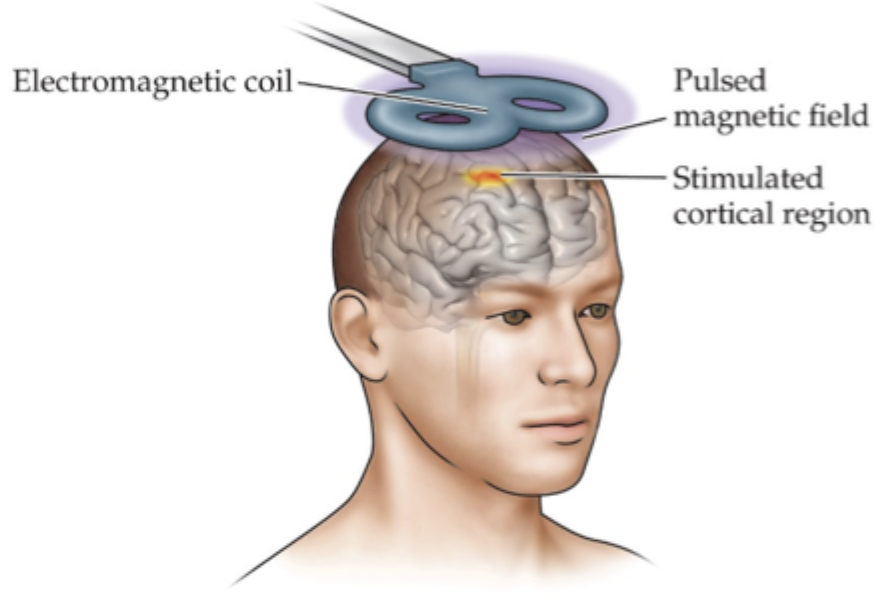<p>Stimulates discrete cortical regions through magnetism</p>