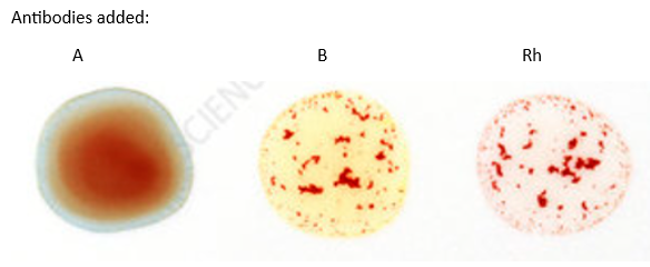 <p><span><span>What is the person's blood type?</span></span></p>