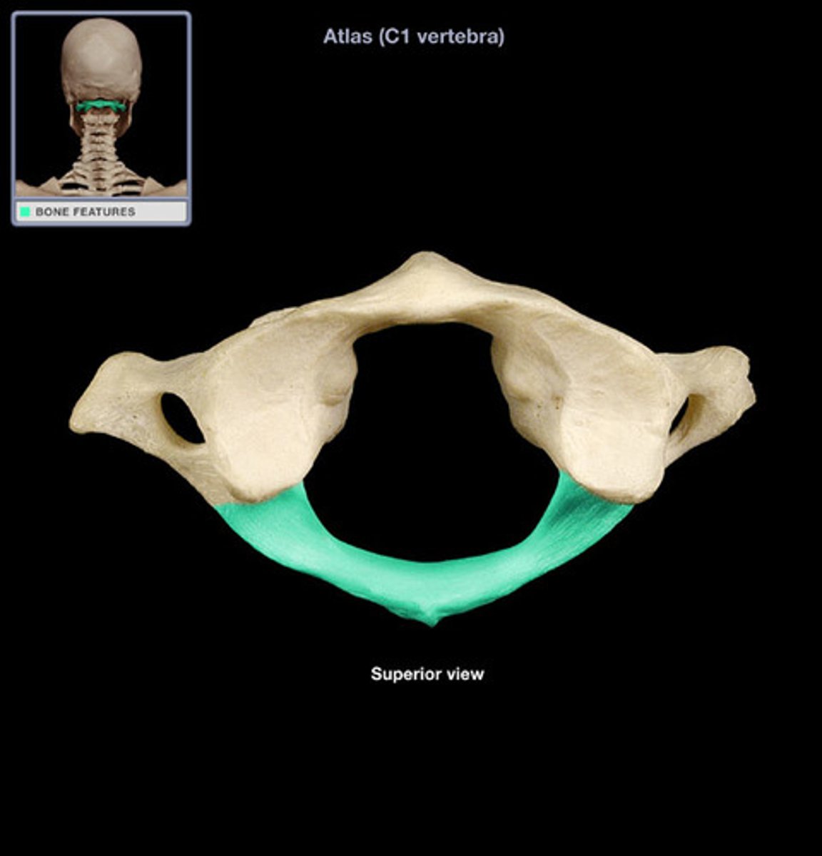 <p>posterior arch</p>