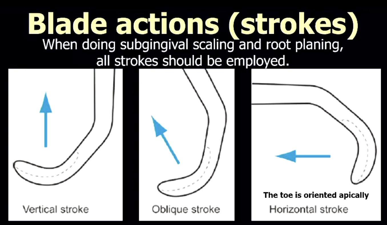 <ol><li><p>vertical</p></li><li><p>oblique'</p></li><li><p>horizontal</p></li></ol><p>When doing subgingival scaling and root planing, all strokes should be employed.</p>