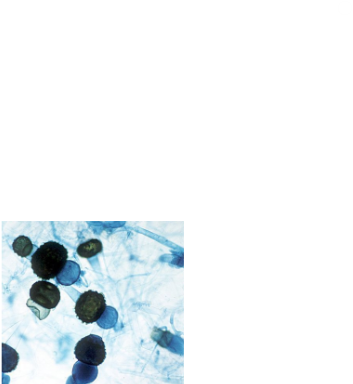 <p>Zigomicetes</p>