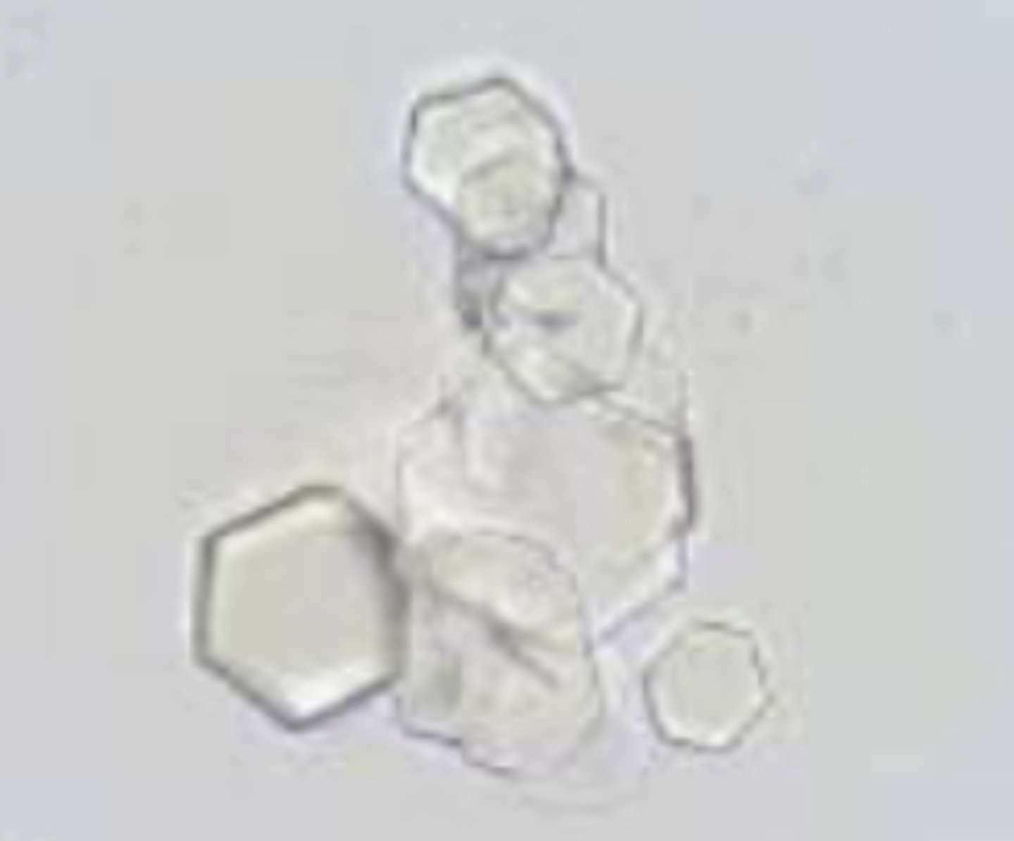 <p>- Flat, 6-sided (hexagonal) shape</p><p>- Thin and colorless</p><p>- Indicates renal tubular dysfunction or cystine bladder stones</p>