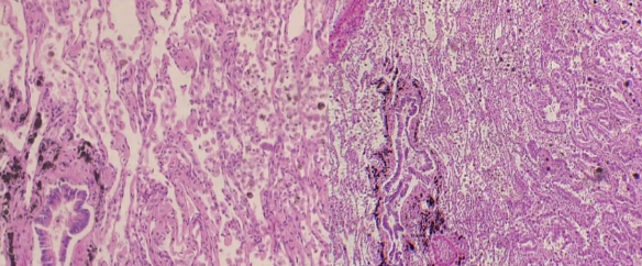 <p>What is the histology?</p>