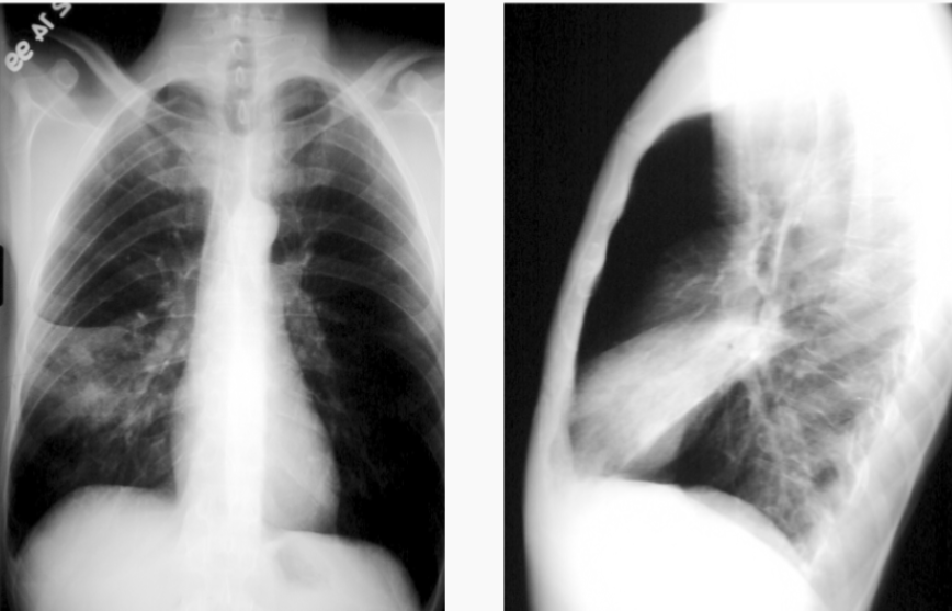 <p>What is this patient presenting with?</p>