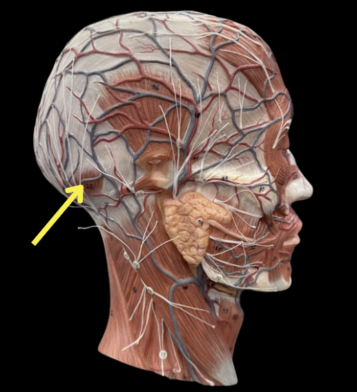 term image
