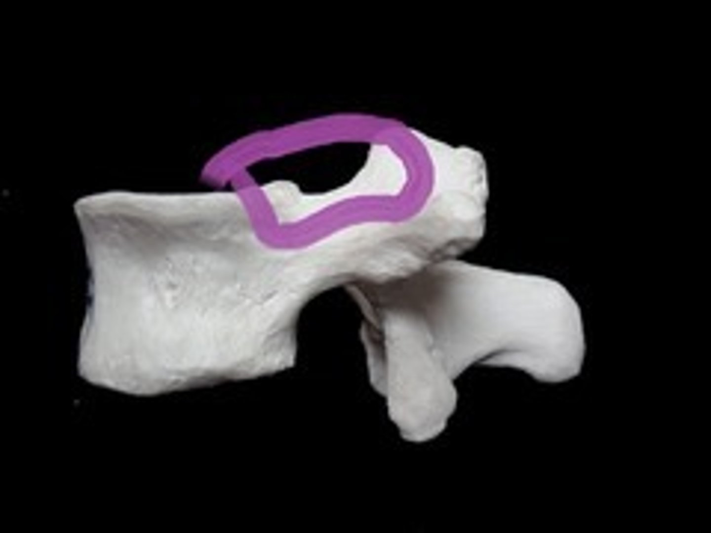 <p>indentation of the body and superior articular process</p>