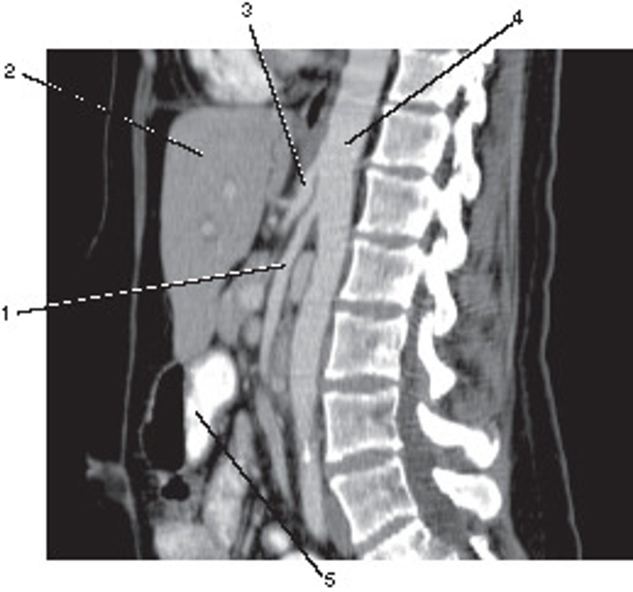 <p>What position was this patient in during data acquisition?</p>