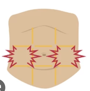 <p>-Left kidney, large and small intestine, spleen</p>