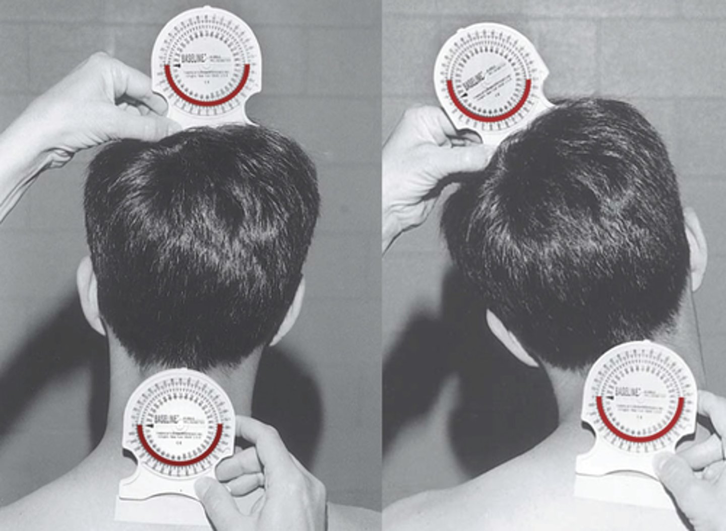 <p>T1 and top of head</p>