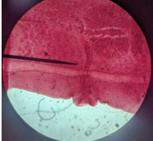 <p>opening on side of proglottids</p>