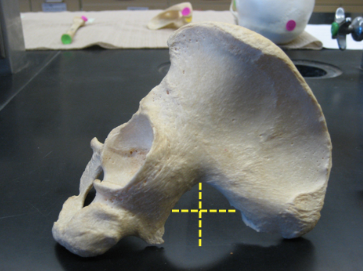 <p>Look at the greater sciatic notch, is this os coxa male?</p>
