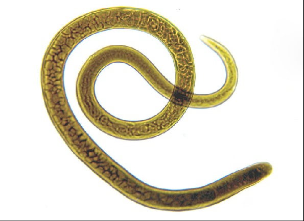 <p>usually roundworms</p><p>have alimentary canal and lack circulatory system&nbsp; </p><p></p>