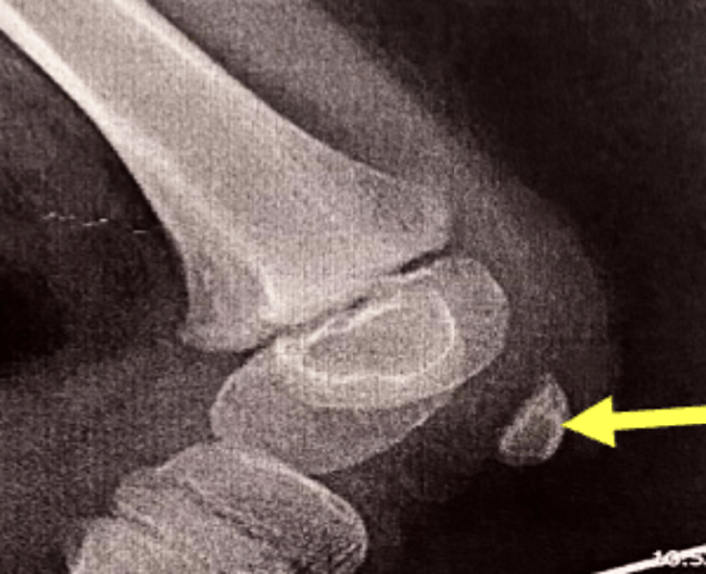 <p>patella</p>