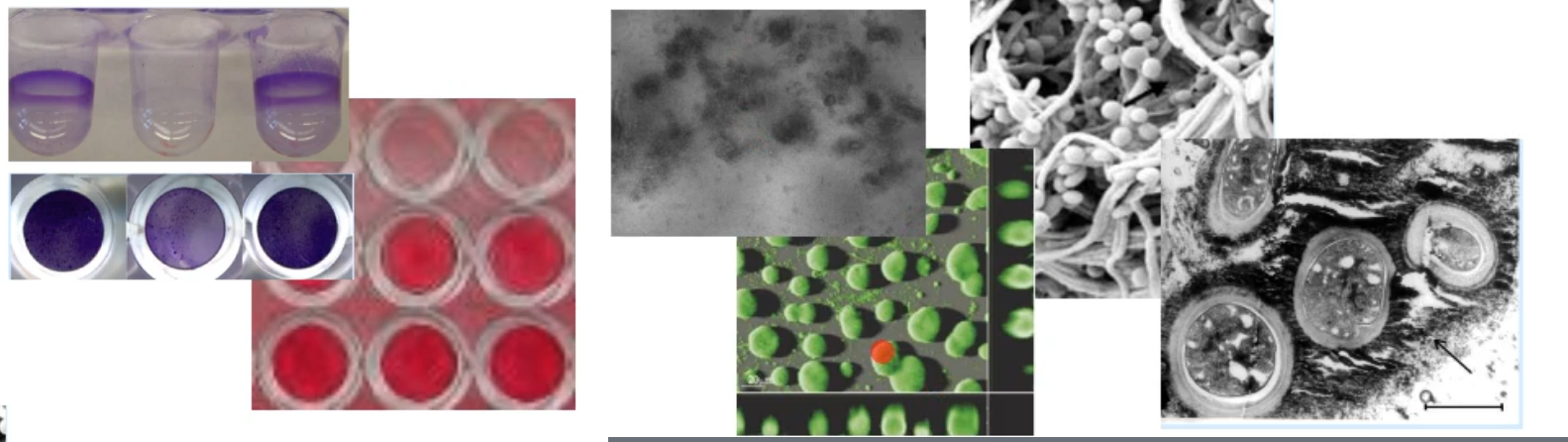 <ul><li><p>stains</p></li><li><p>microscopy</p><ul><li><p>light</p></li><li><p>confocal</p></li><li><p>SEM</p></li><li><p>TEM</p></li></ul></li></ul><p></p>